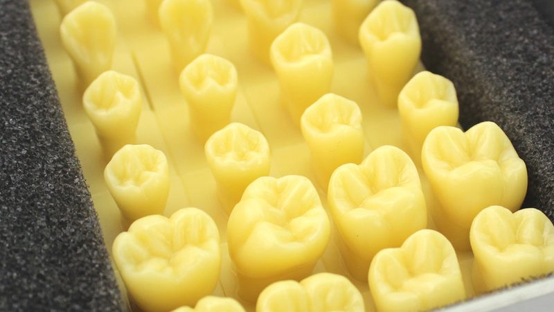 带孩子全口种植，家长关心的三大问题
